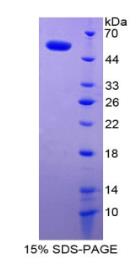 SDS-PAGE (SDC1-2033H).jpg